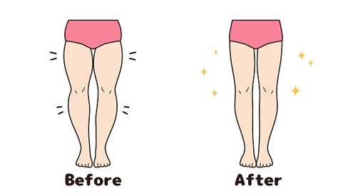 Leg Diet Before And After Set Stock Illustration - Download Image Now ...