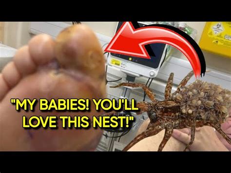 "Thanks for permanent nightmares": Peruvian wolf spider eggs in toe ...