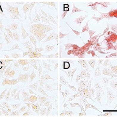 Congo Red Staining Showing The Increased Internalization In