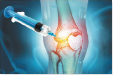 Ha Injections For Knee Pain Arthritis Advisor