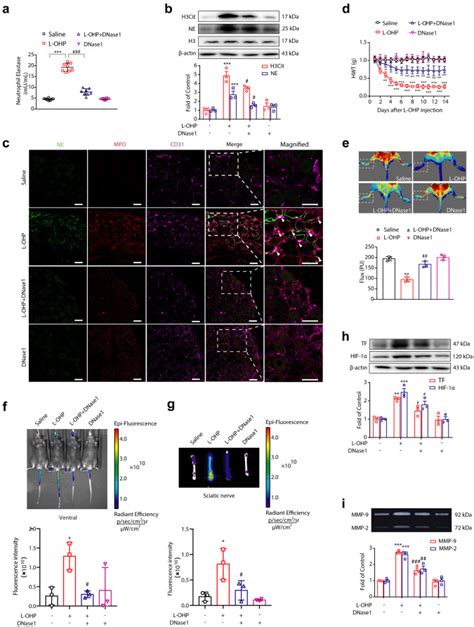 Neutrophil Extracellular Traps As A Unique Target In The Off