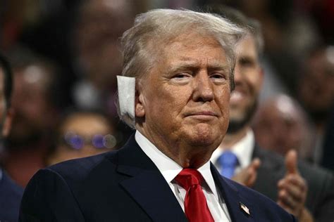 El médico de Trump dio detalles sobre la herida tras el ataque La