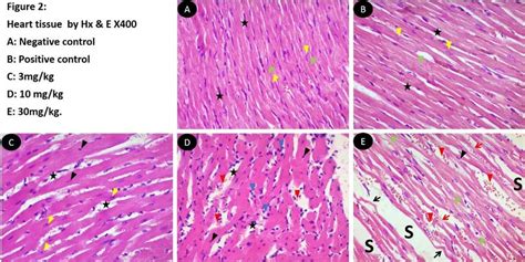 Photomicrograph Of Cardiac Tissue By Hx E A And B Branching