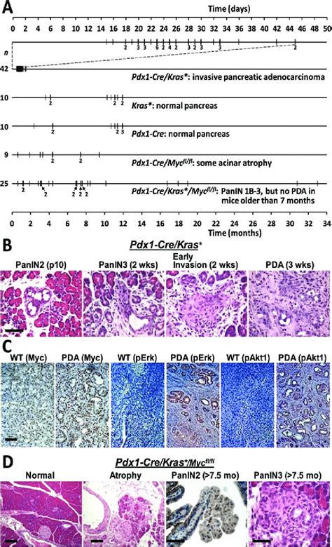 Myc Dependence Of Oncogenic Kras Kras Induced Pancreatic Cancer A