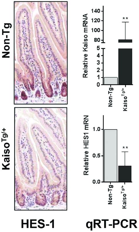 Kaiso Tg Mice Display Decreased Hes 1 Expression In The Small