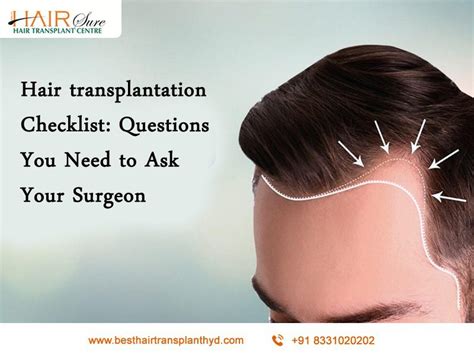 Hair Transplantation Checklist Questions You Need To Ask Your Surgeon Cyber Hairsure