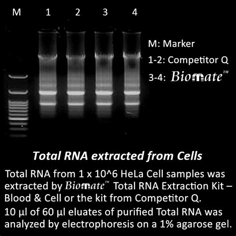 Total Rna Extraction Kit Blood Cell