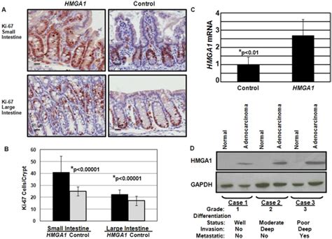 A Ki 67 Staining Of Small And Large Intestines From Hmga1 Transgenics Download Scientific