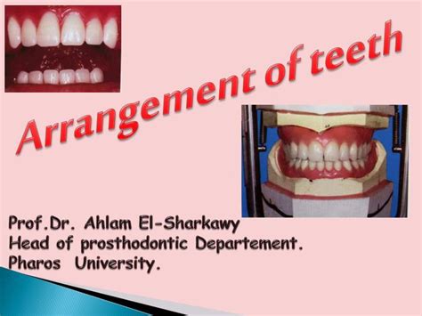 Ppt Arrangement Of Teeth Powerpoint Presentation Free Download Id