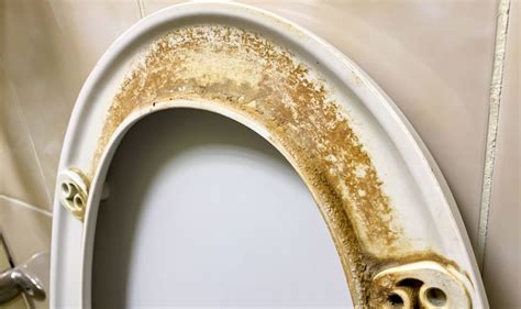 Easy Methods To Clean Toilet Seats ‘magic Item To Remove Yellow