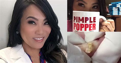 This Dermatologists Pimple Popping Videos Are Blowing Up The Doctor