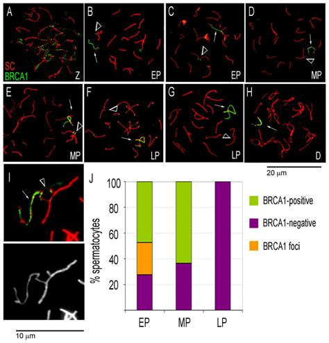 Dynamics Of BRCA1 Localization In Meiotic Prophase I Spermatocytes From