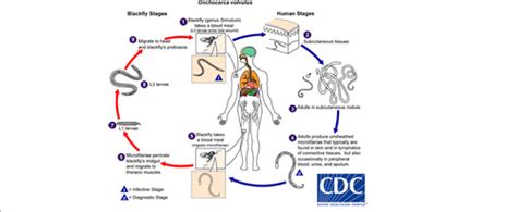 Onchocerca volvulus Flashcards | Quizlet