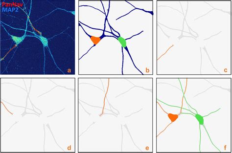 Neuron Tracing A Confocal Image Of Cultured Neurons Mip View Download Scientific Diagram