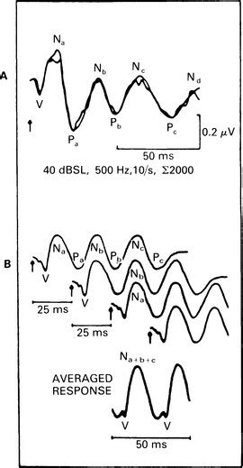 Middle Latency Responses Mlr Basicmedical Key