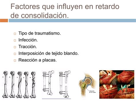 Proceso de consolidación ósea PPT