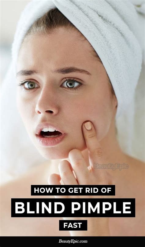 13 Easy Ways to Get Rid of Blind Pimple Fast Skin Care Pimples, Skin Care Masks, Acne And ...