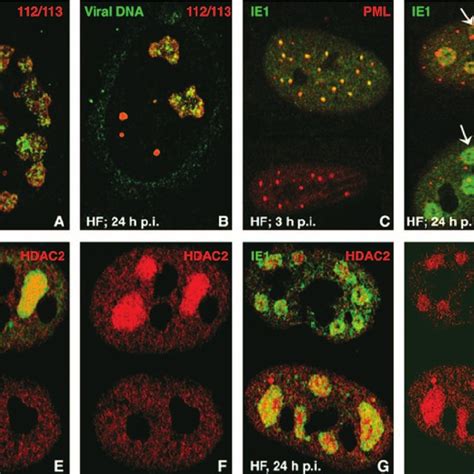 Mcmv Dna Replication And Ie Distribution In Human Fibroblasts A In