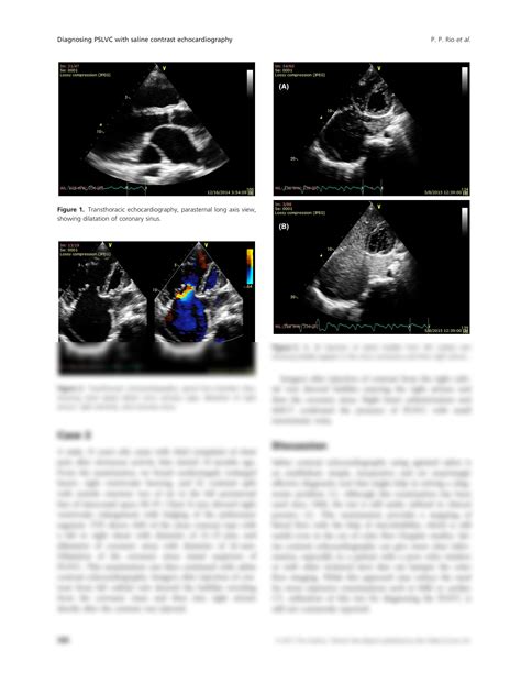 Solution Persistent Left Superior Vena Cava In Atrial Septal Defect