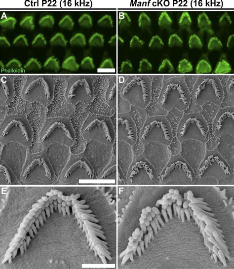 Cochlea Hair Cells