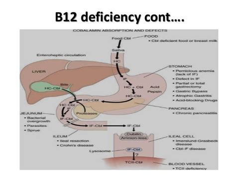 Vit b12 deficiency causes and management