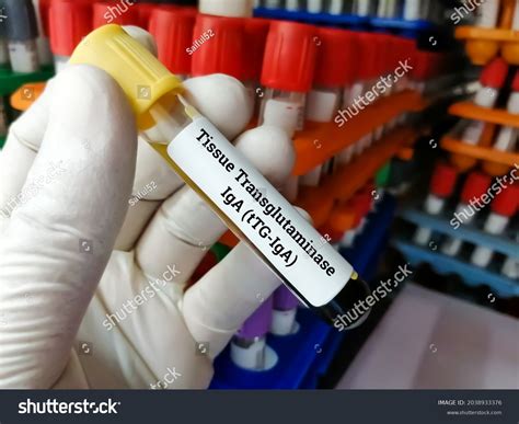 Blood Sample Tissue Transglutaminase Antibody Ttg Stock Photo 2038933376 | Shutterstock