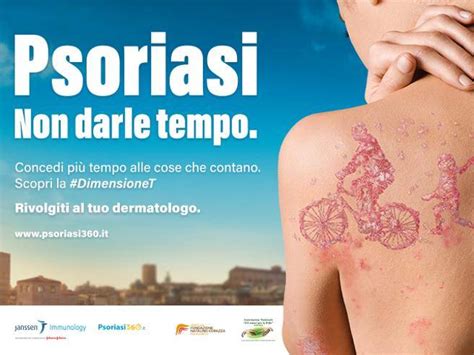 Malattia Psoriasica Parte La Campagna Itinerante Oltre Le Apparenze