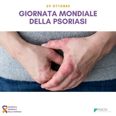 GIORNATA MONDIALE DELLA PSORIASI PIZETA Pharma