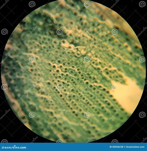 Yeast Cells Under Microscope 400x Micropedia