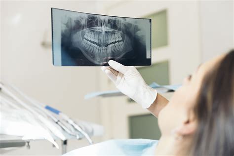 Everything You Need To Know About Dental X Rays From Dentist