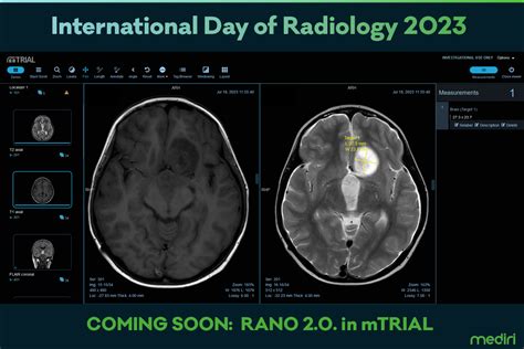 International Day of Radiology 2023