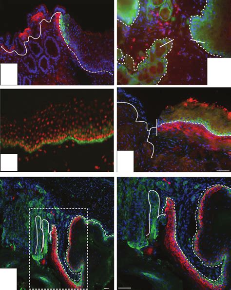 Wound And Inflammatory Markers At Transition Zones Immunofluorescence