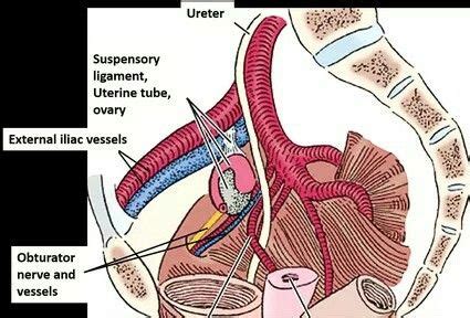 Ovary Lies Opposite To The Ovarian Fossa In Front Of The Ovarian Fossa