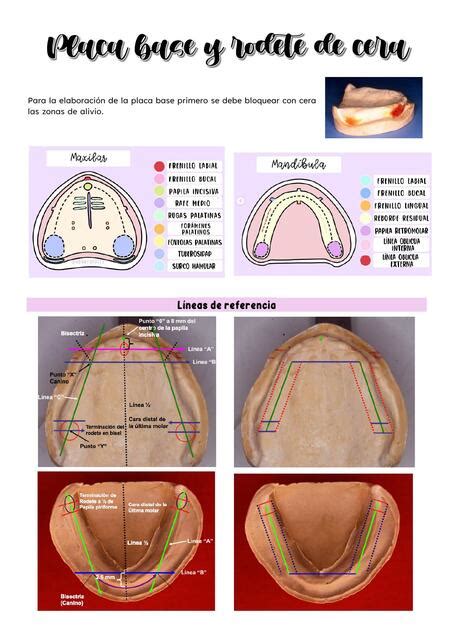 Placa base y rodete de cera PRÓTESIS TOTAL Johanna Mendoza Costilla