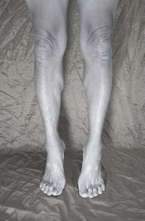 The Muscles Of The Legs Of The Elderly With Atrophy Stock Image Image