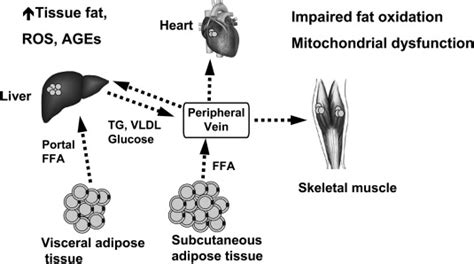 Ectopic Fat And Cardiovascular Disease What Is The Link Nutrition