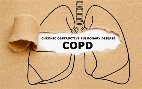 5 Breathing Exercises For COPD: Effective Relief The Simple Way