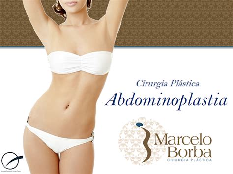 Dr Marcelo Borba Cirurgia Plástica ABDOMINOPLASTIA Valorizando o