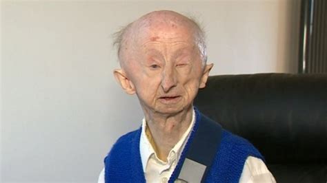 Alan Barnes Fund Donations Halted For Mugging Victim Bbc News