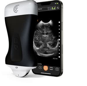 Ecógrafo de mano L20 HD3 Clarius Mobile Health para ecografía