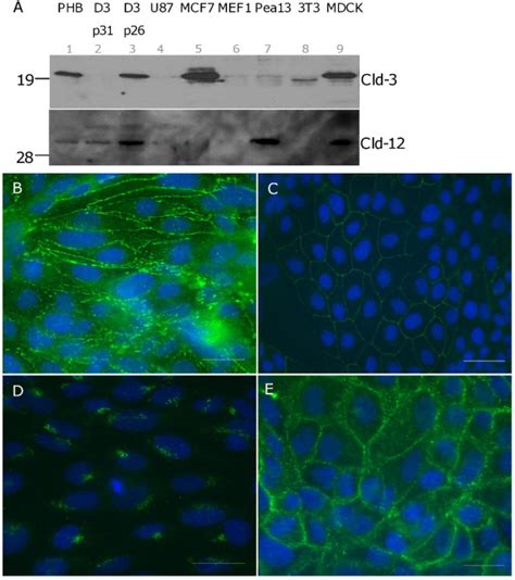 Claudin 3 And Claudin 12 Expression In Hcmec D3 Cells A Immunoblots Download Scientific