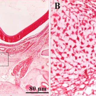 Mesenchymal Cells During The Initial Stages Of Cartilage Formation