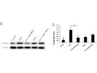 Western Blot