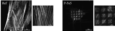 Organization Of The Actin Cytoskeleton In Primary Human Osteoblasts Hob