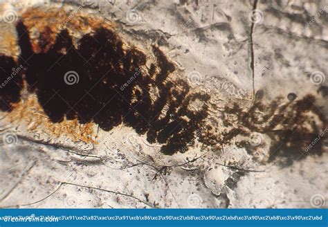 Pinworms Eggs Enterobius Vermicularis In Stool Examination Under ...