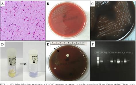 Figure From Gardnerella Vaginalis In Perinatology An Overview Of The