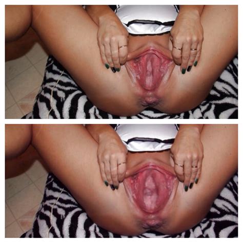 Fat Pussy Meat Of Ruined Gaped Huge Cunts 35 Pics XHamster