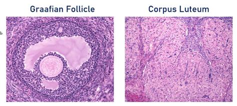 Graafian Follicle _ Corpus Luteum_Histology | Medical Science Navigator