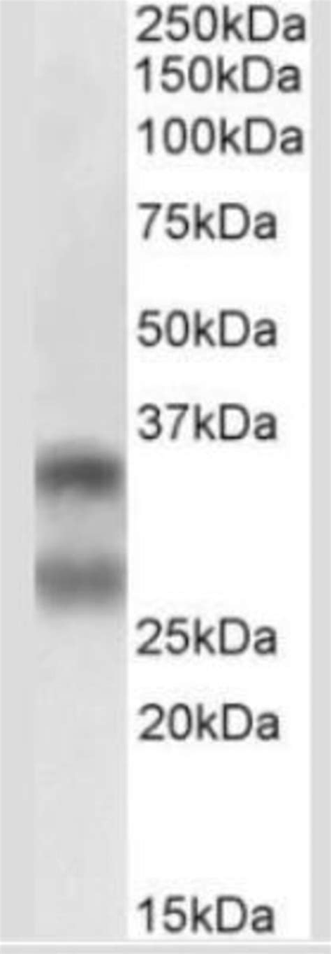 TRANCE TNFSF11 RANK L Antibody 12A668 Azide And BSA Free Novus