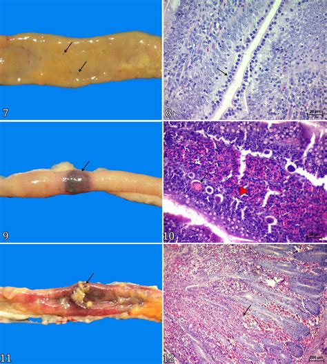 Macroscopic Lesions Suggestive Of Necrotic Enteritis NE And